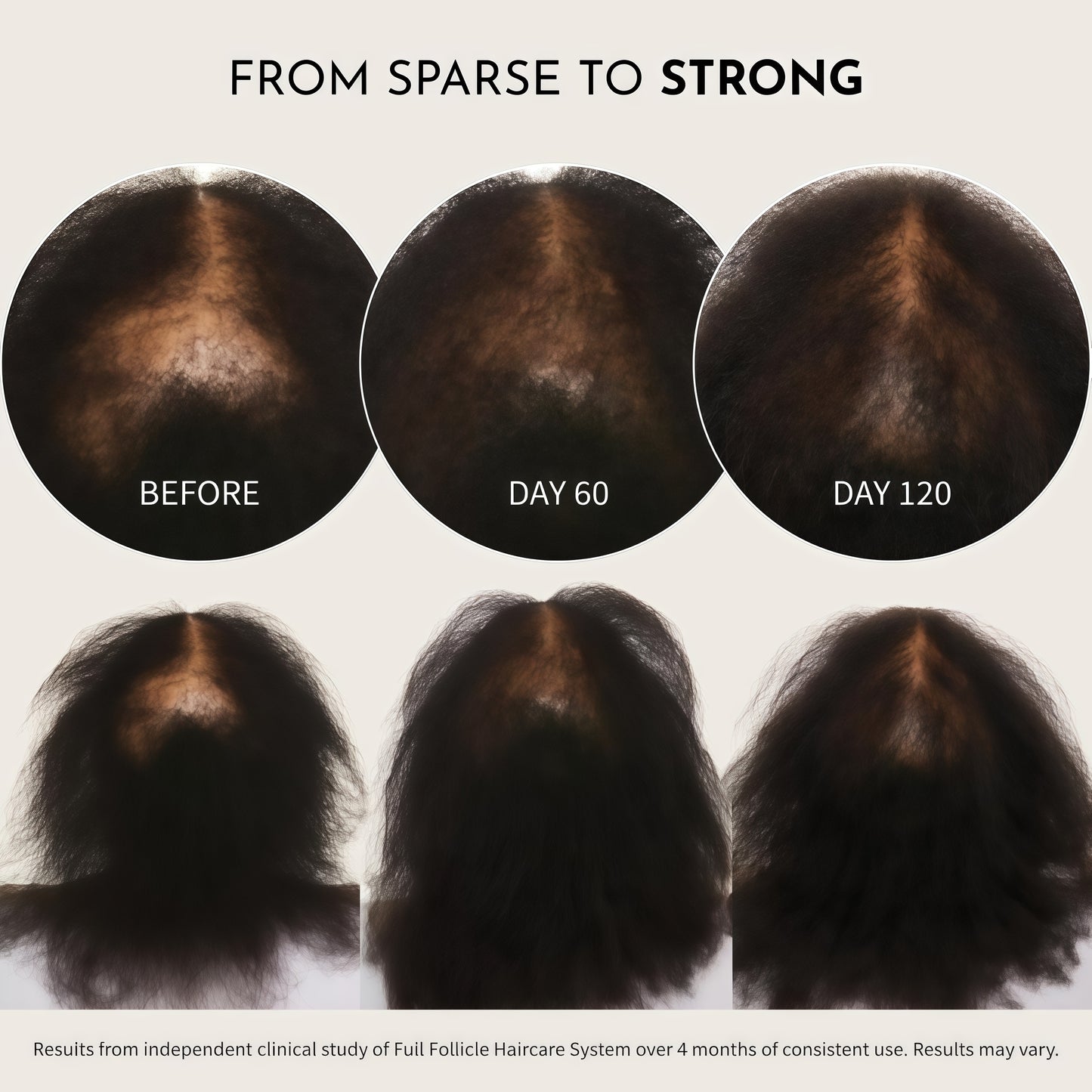 Full Follicle Advanced Scalp Serum